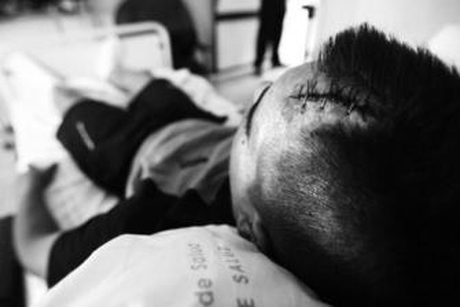 Juan Román se recuperaba ayer en el Puerta del Mar de Cádiz tras sufrir una fisura craneal.