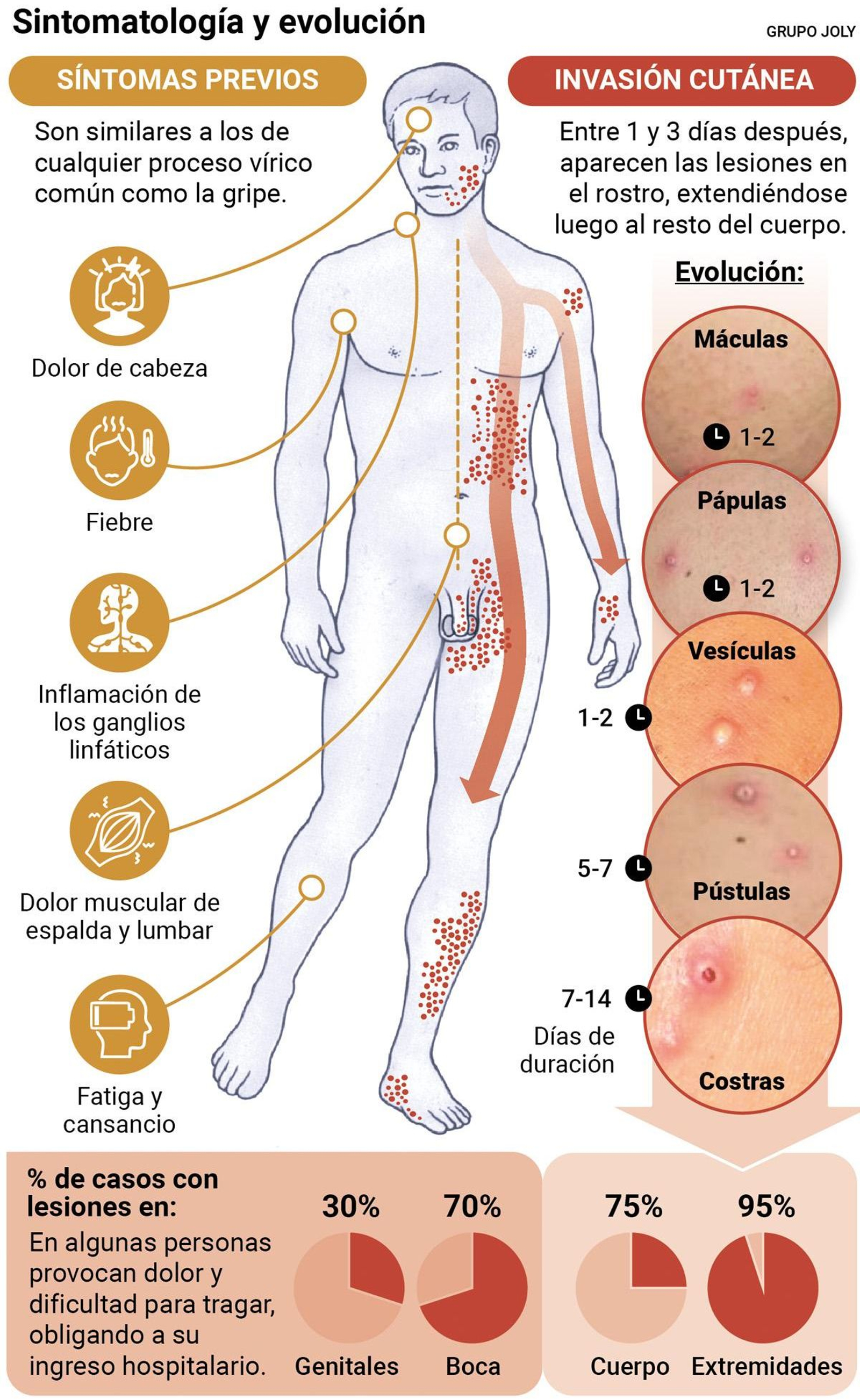 Sintomatología y evolución de la viruela del mono. Fuente: Organización Mundial de la Salud.