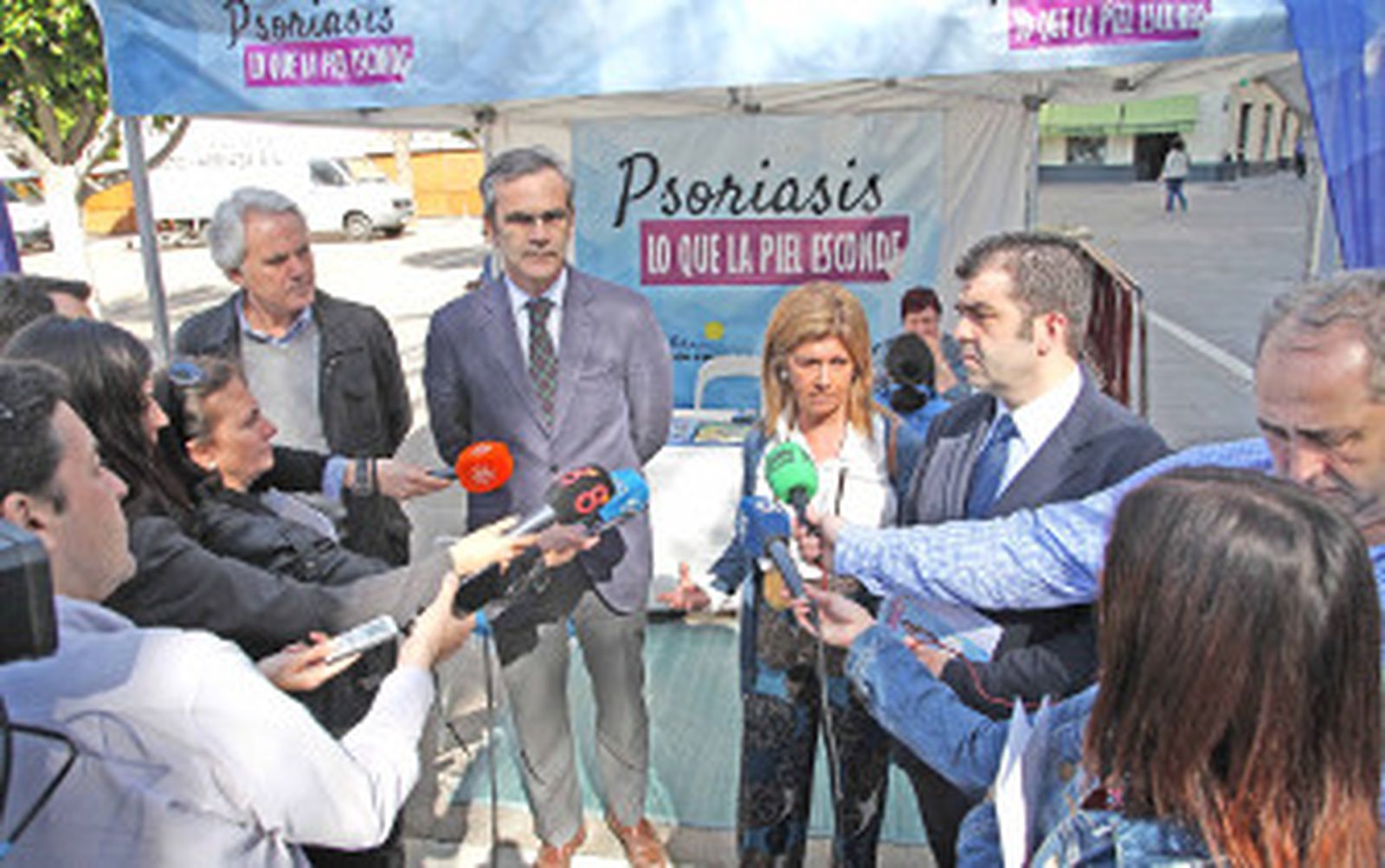 Psoriasis, la enfermedad de la piel que afecta a 4.900 jerezanos