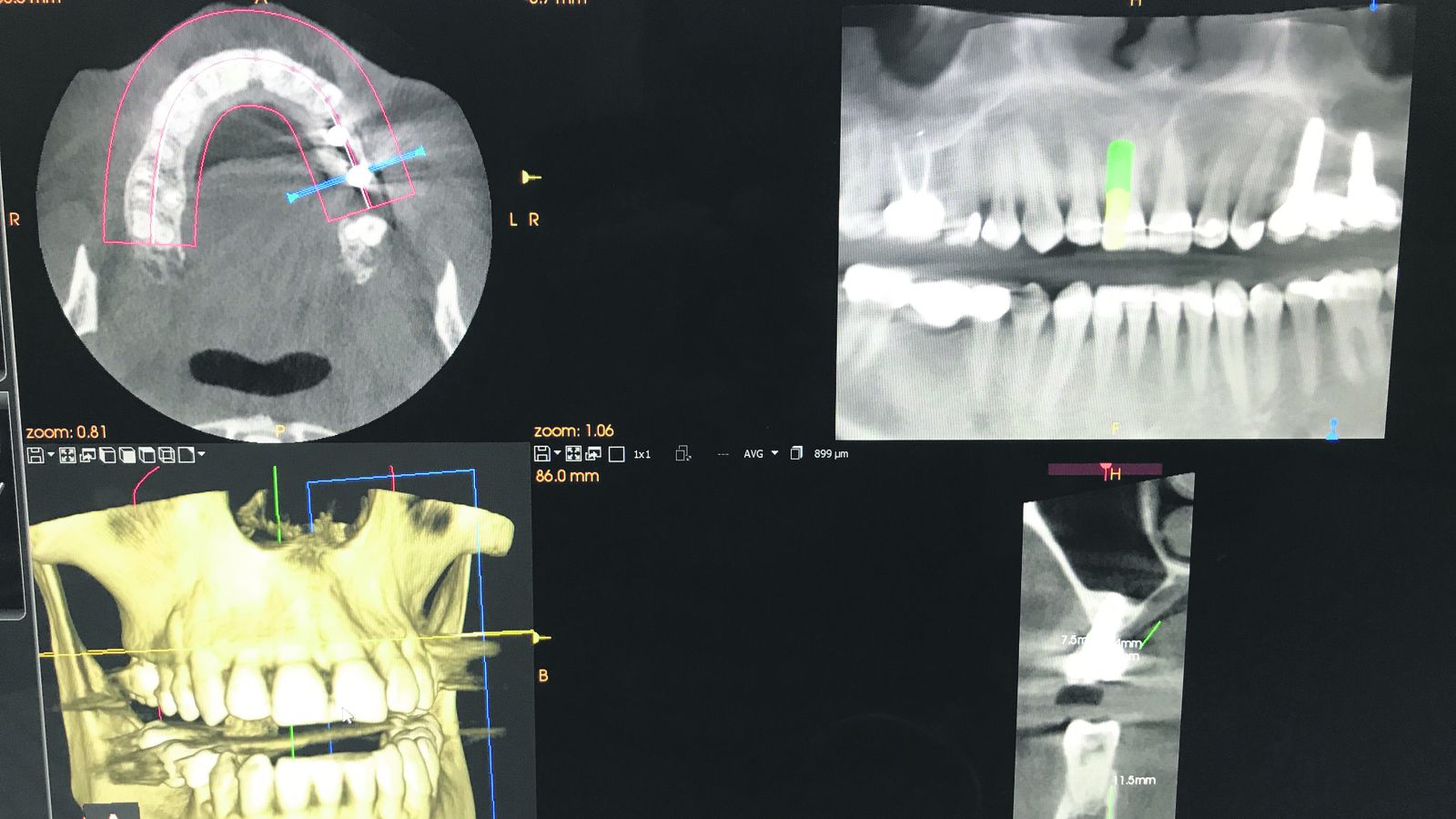 Técnicas de lo más avanzadas.