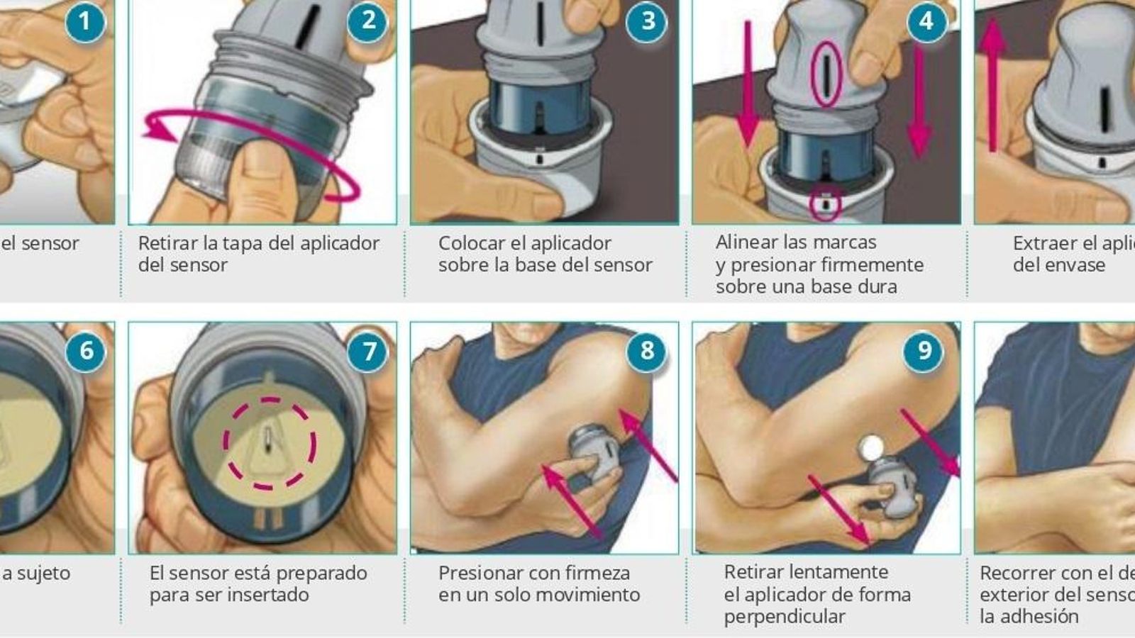 Guía para la colocación del dispositivo.