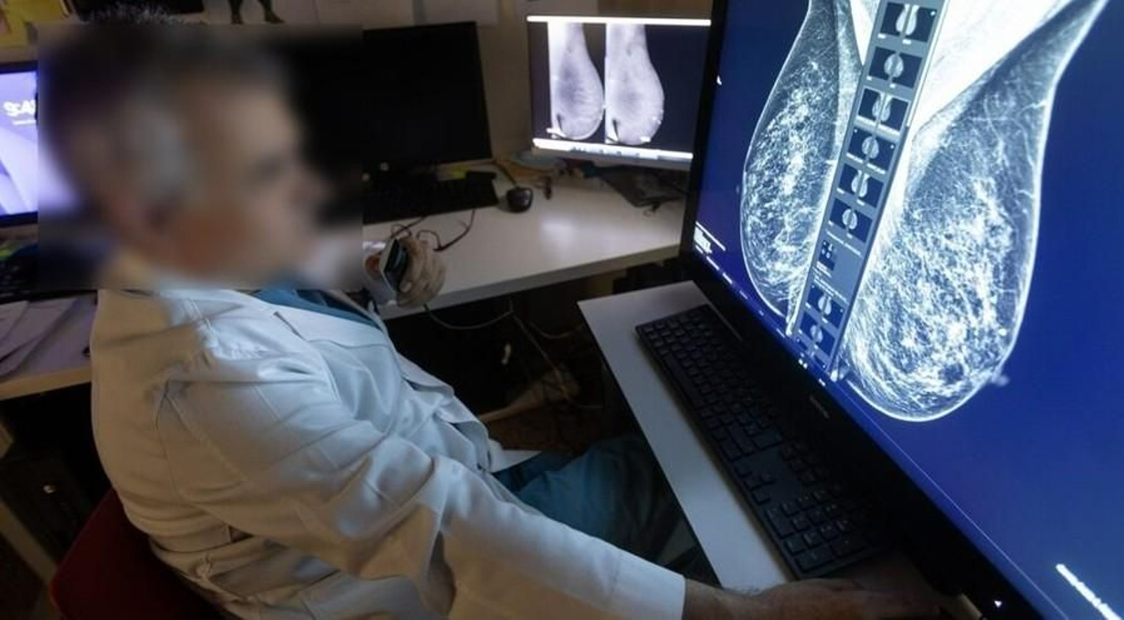 Un radiólogo analiza las imágenes de una mamografía.