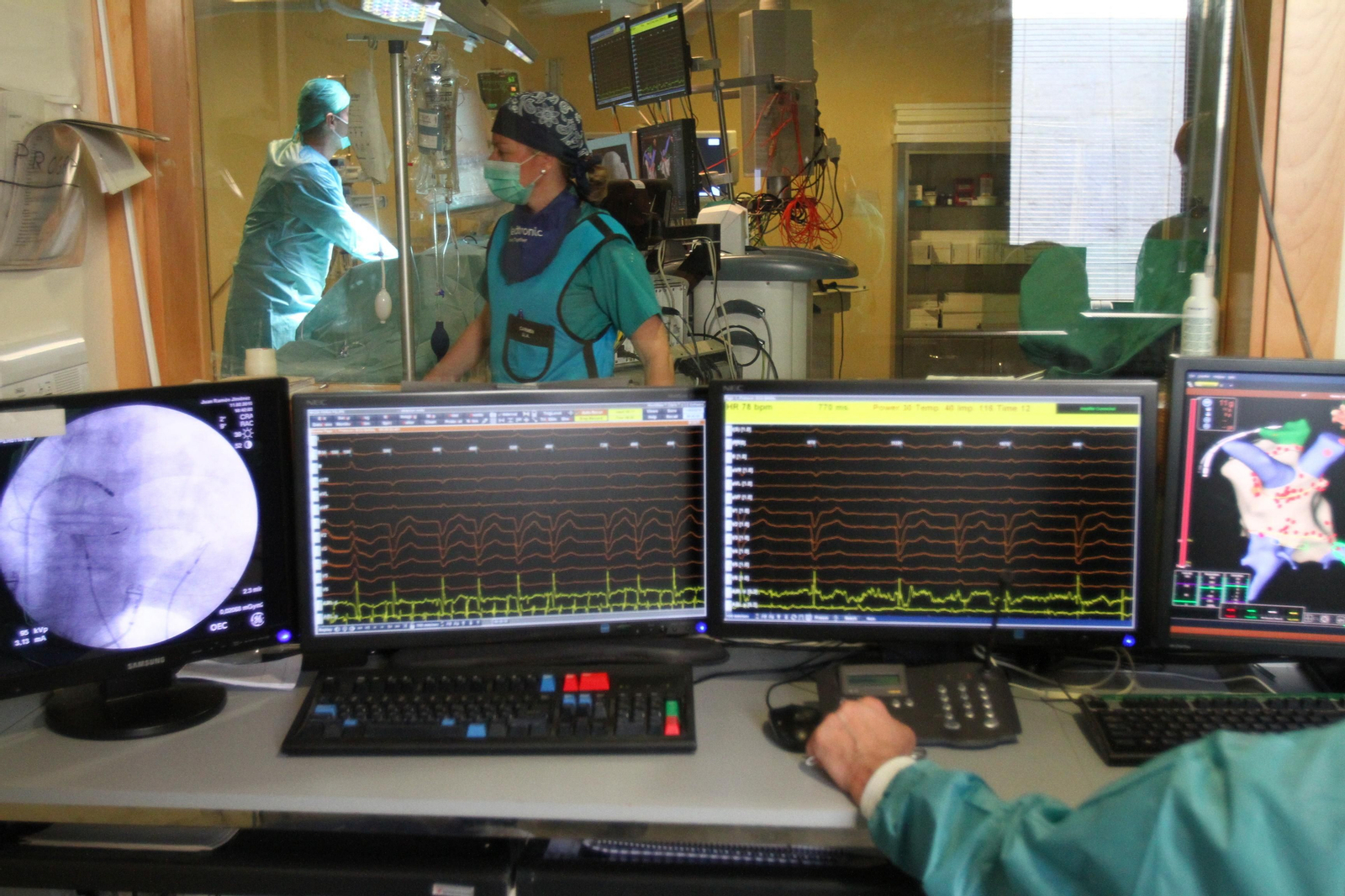 El Hospital Juan Ramón Jiménez implanta los dos primeros marcapasos sin cable en pacientes onubenses