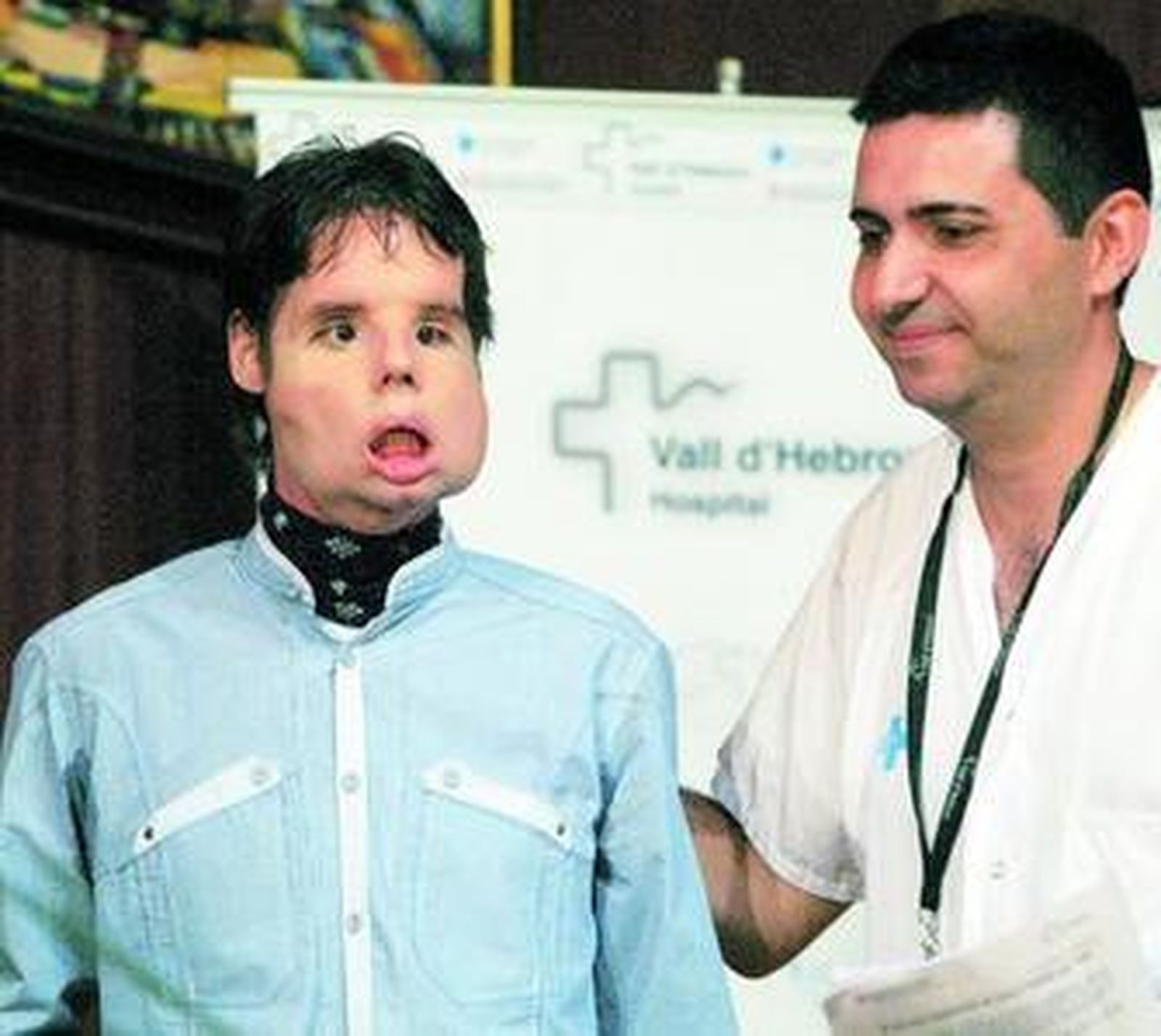 El primer trasplante total de cara del mundo39 22