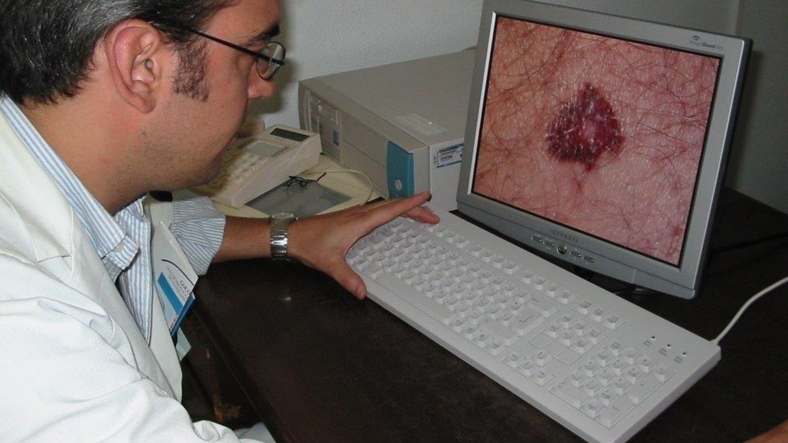 Un dermatólogo analiza la imagen de una mancha en la piel a través del Servicio de Teledermatología del SAS.