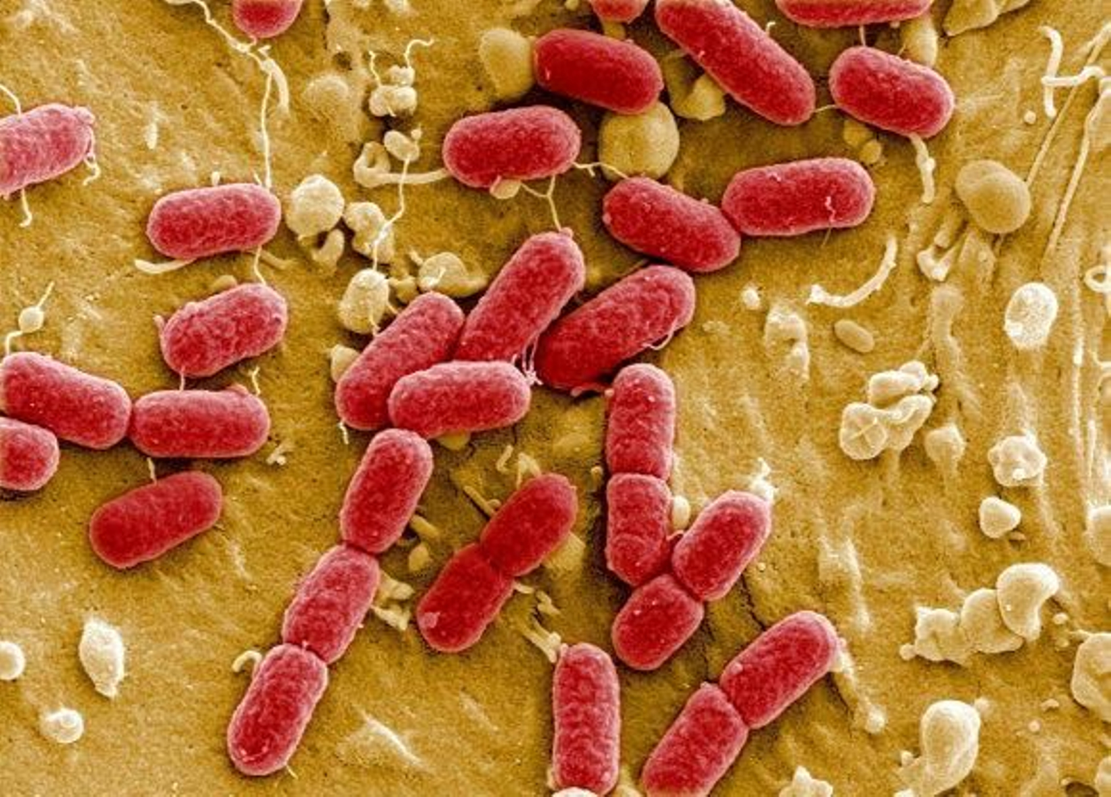 Una bacteria de origen indefinido causa seis muertos y mil afectados en Alemania