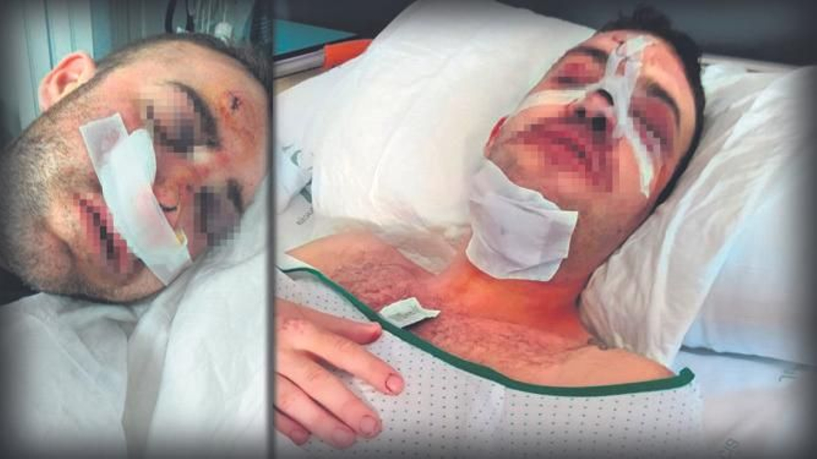 Dos fotografías de las lesiones sufridas por la víctima.