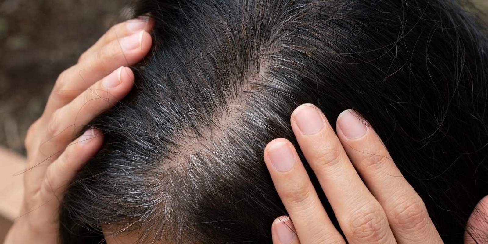 Vitaminas y alimentos que previenen la aparición de canas