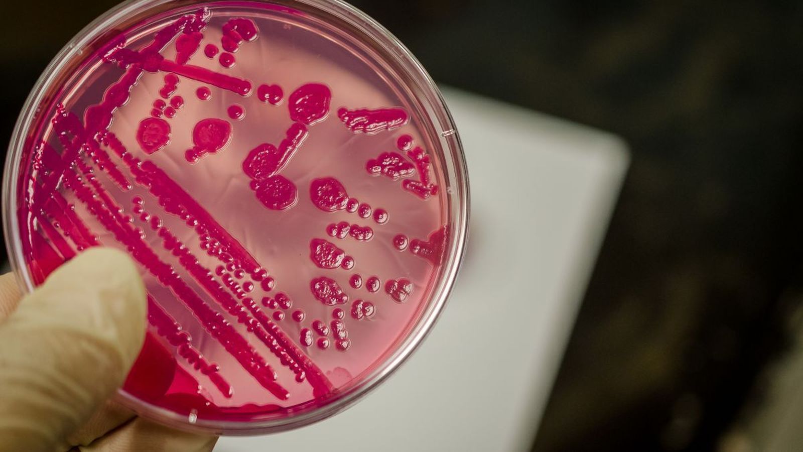 Detectado un brote de salmonelosis en Gerena por consumo de carne en mal estado
