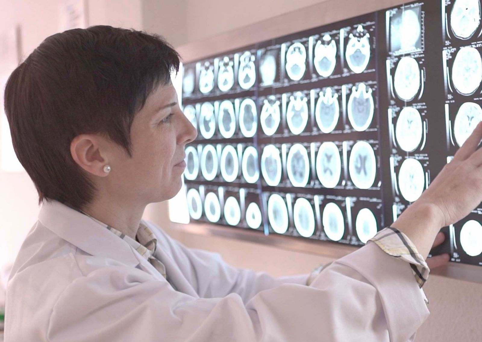 La doctora Belén Moliner, directora médico de Vithas Neuro Rehab Human Brain (NeuroRHB).