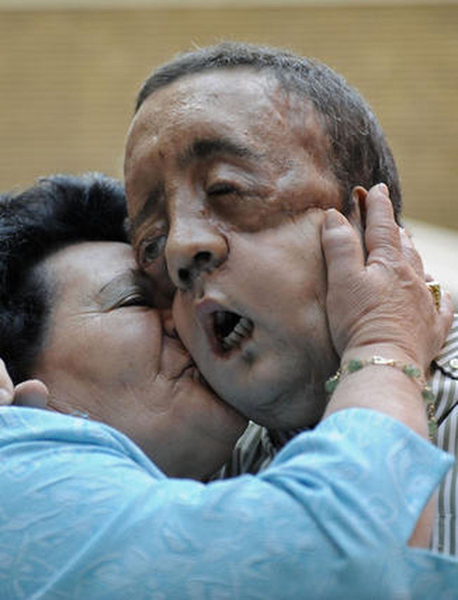 Rafael y su madre se abrazan tras la comparecencia del paciente tras ser dado de alta.

Foto: Juan Carlos Vázquez