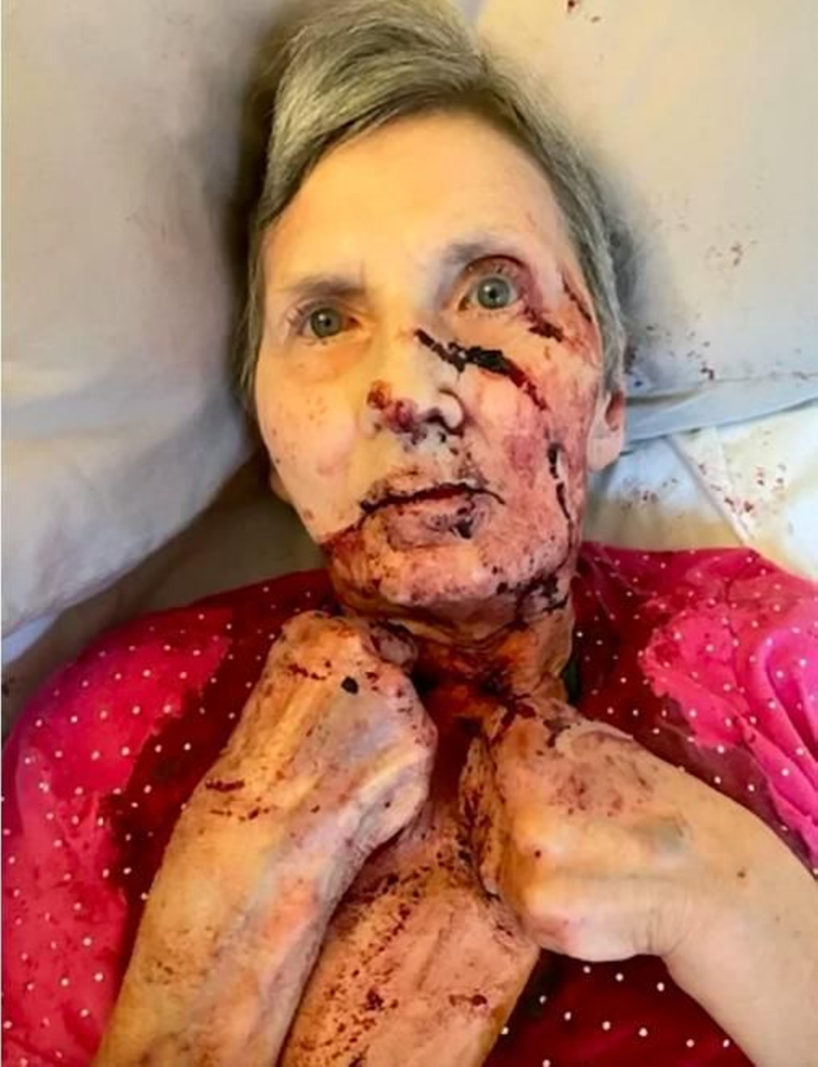 Diana tras el ataque