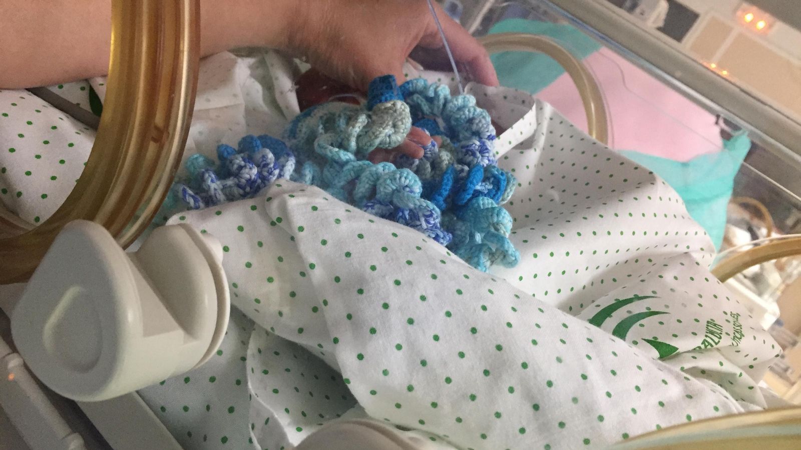 Un bebé prematuro se agarra a un pequeño pulpo.