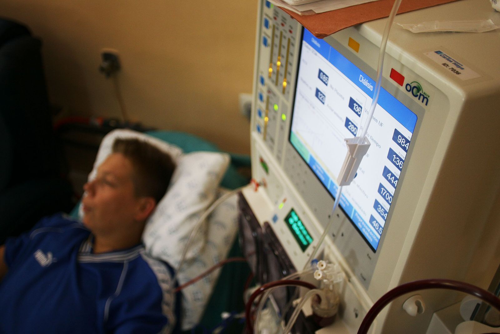 Un paciente recibe una sesión de diálisis