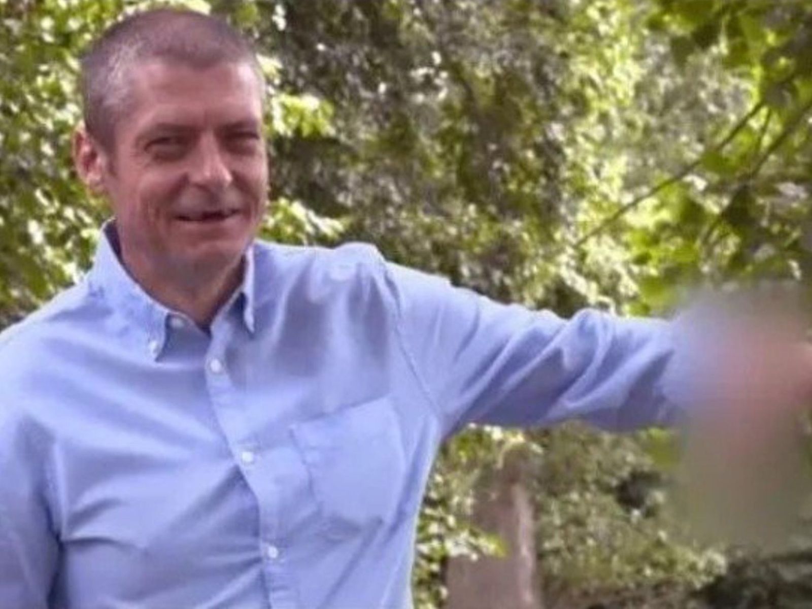 Malcolm MacDonald muestra una foto con el brazo con el pene injertado