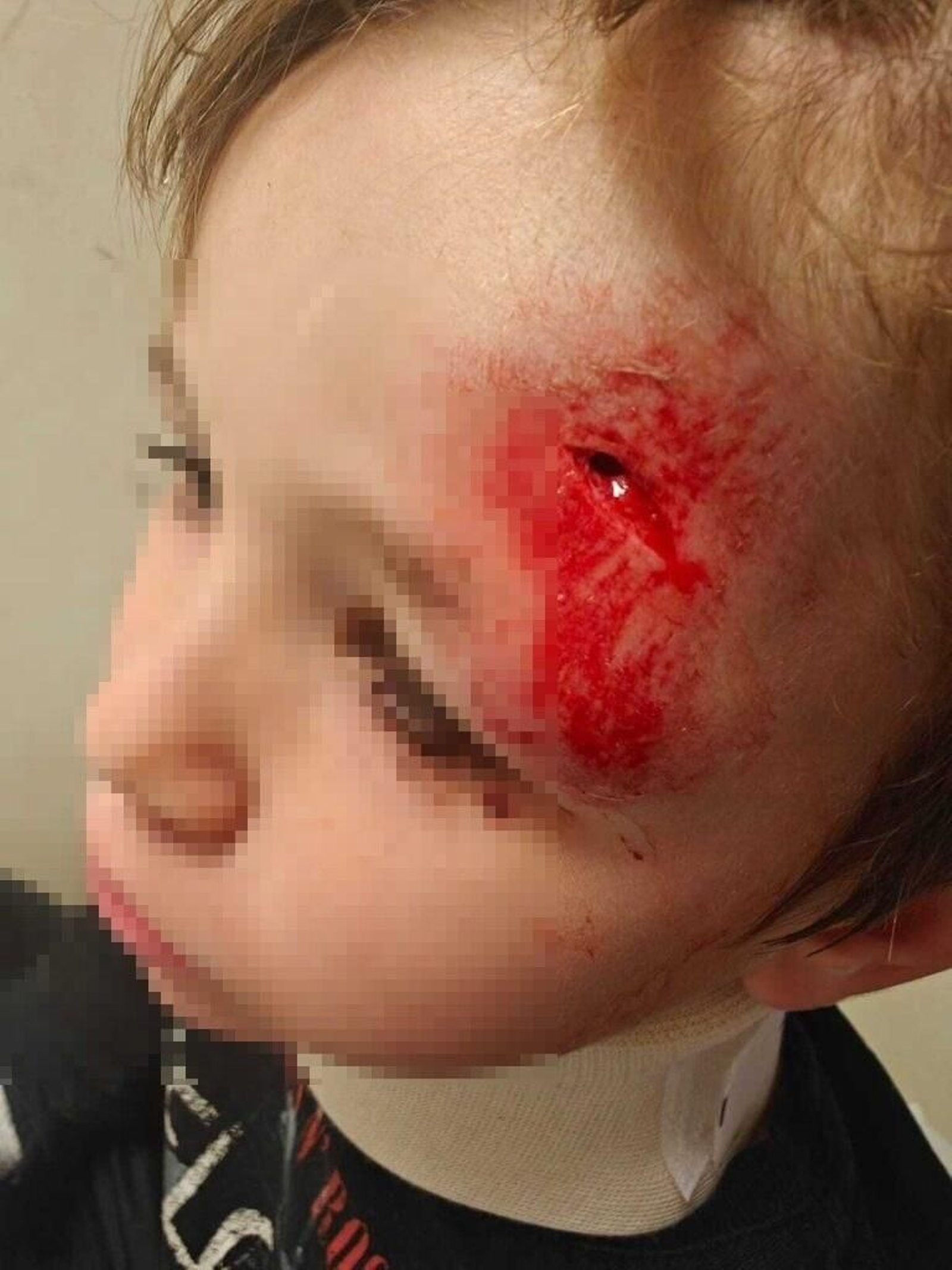 El niño que ha resultado herido