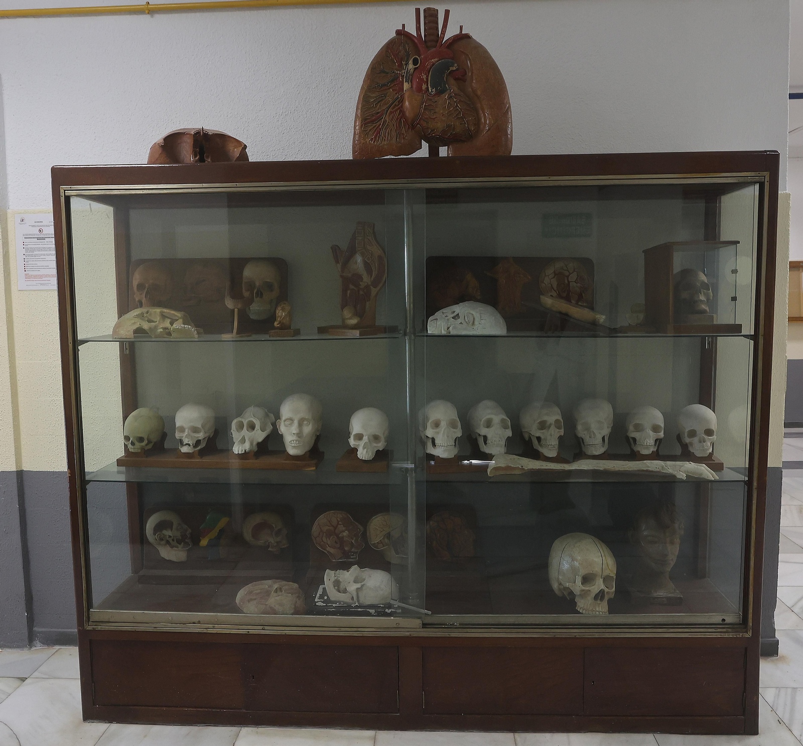 Restauración de esculturas anatómicas usadas con fines docentes entre el siglo XVIII y el XX en la Facultad de Medicina de la US