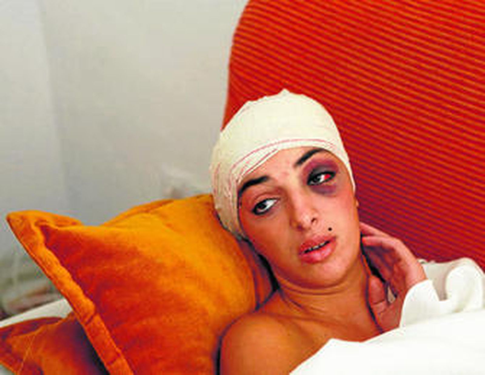 La mujer, ayer, en su domicilio con la cabeza vendada y un fuerte moratón en su ojo izquierdo, tras abandonar el hospital.