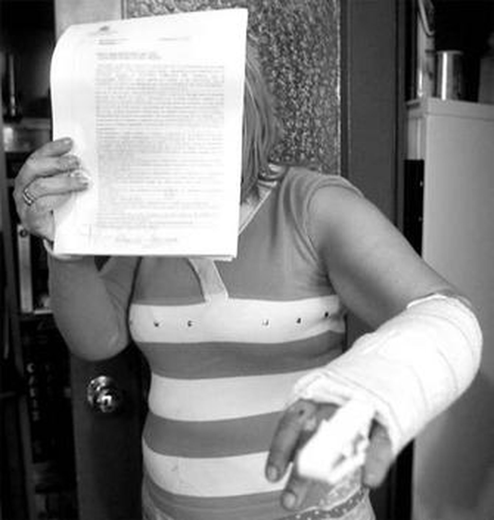 La mujer agredida muestra ayer el brazo lesionado mientras cubre su rostro con la denuncia policial.