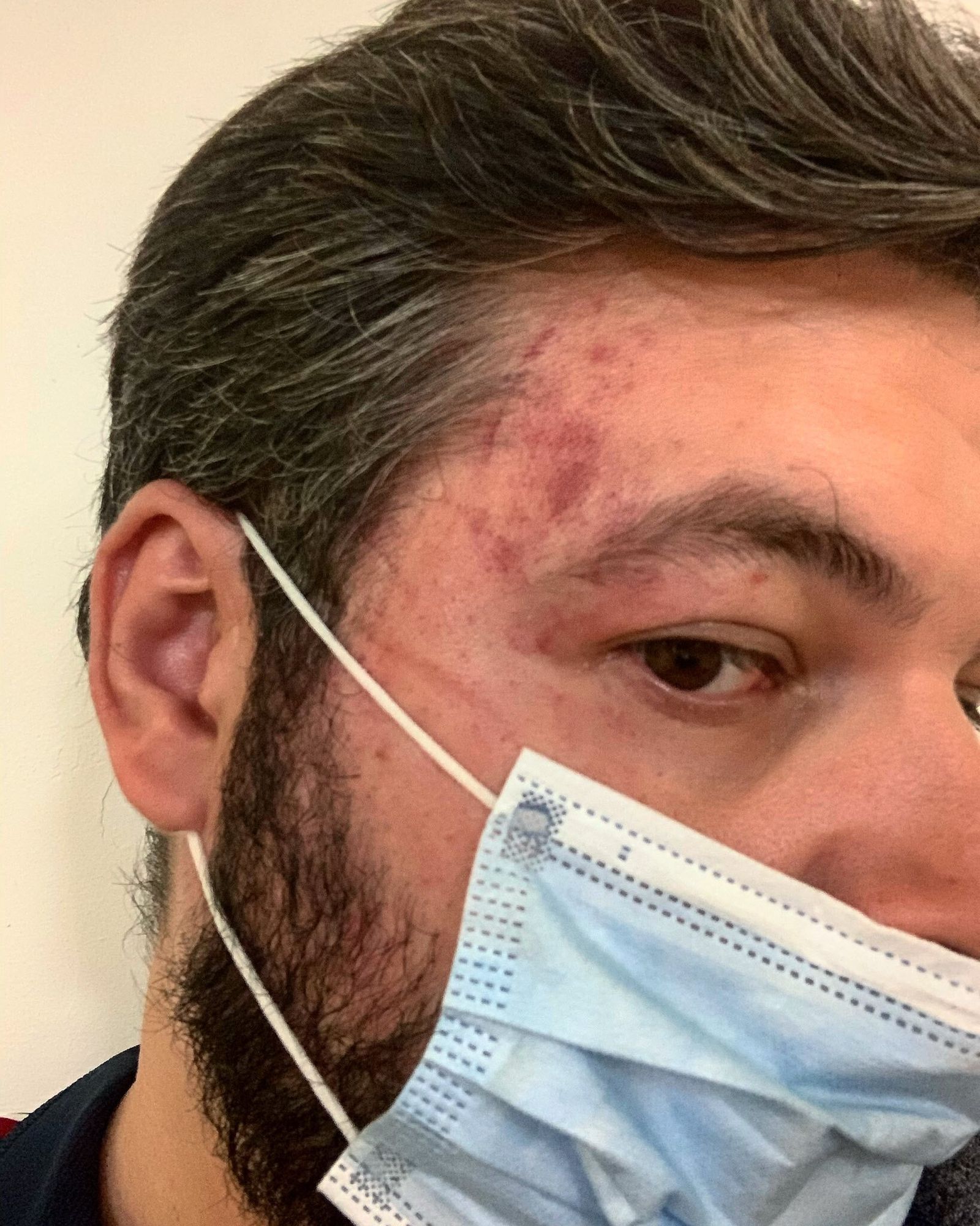 La fotografía publicada por Rubén Pulido, en la que se aprecian las lesiones.