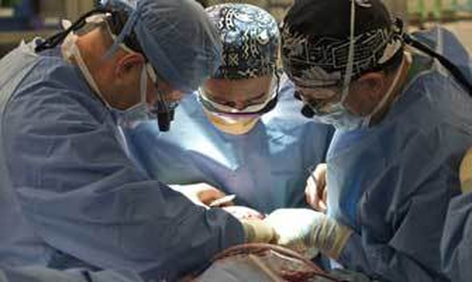 Un equipo de cirujanos en plena operación.   Foto: Efe