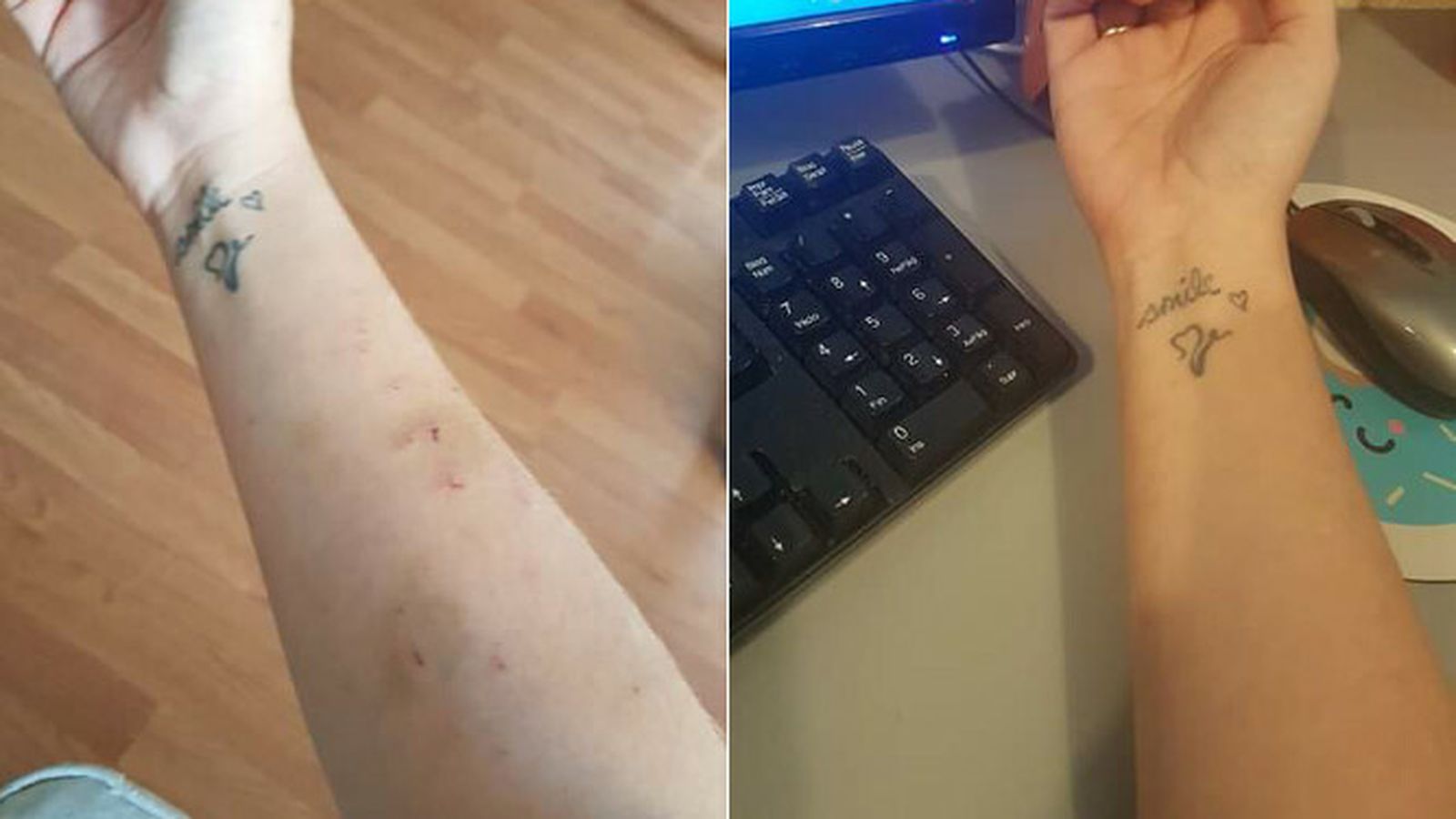 El mismo brazo, herido y sano, de la madre de la niña autista de Dos Hermanas.