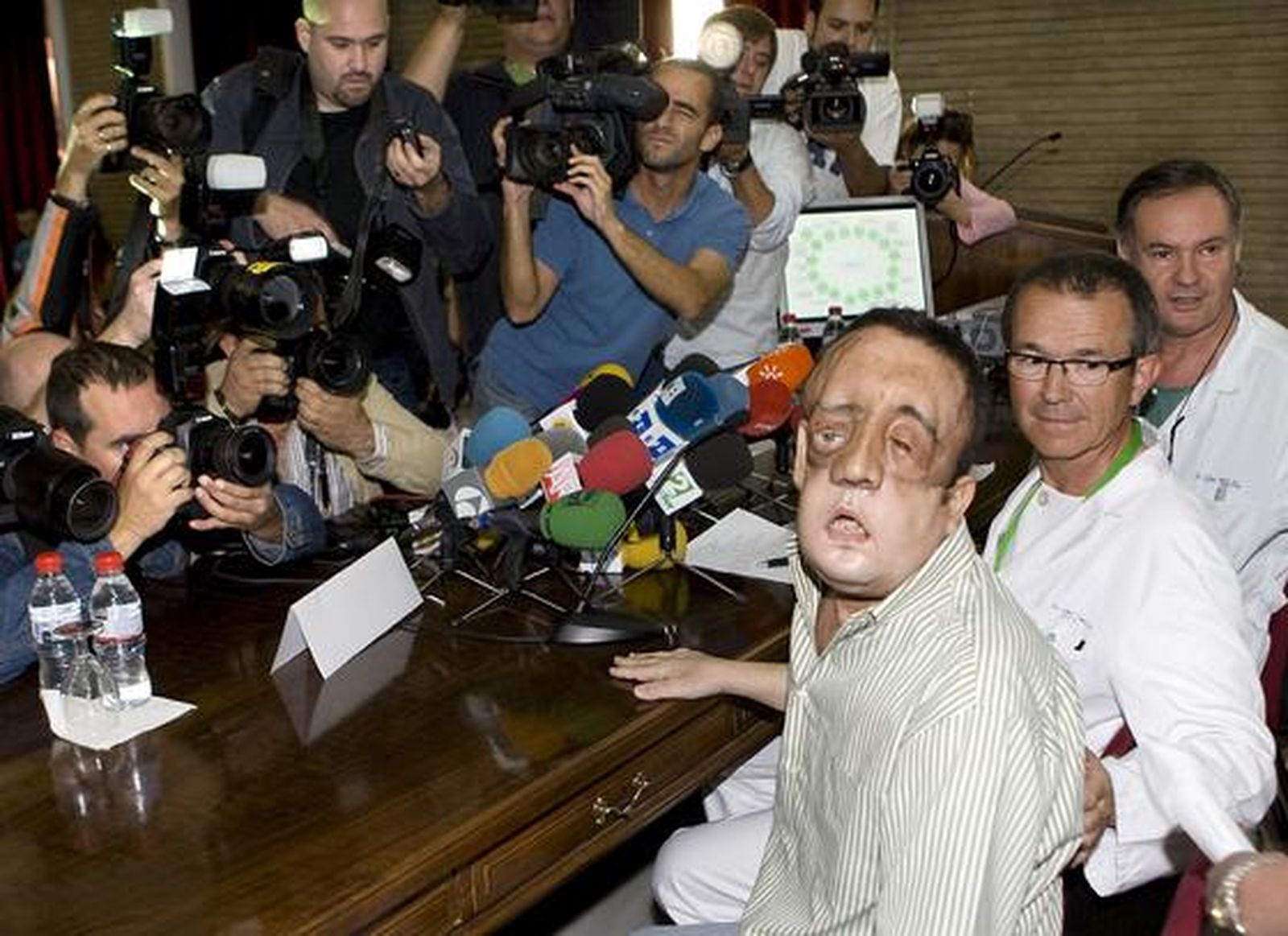 Rafael comparece ante los medios junto al equipo médico que llevó a cabo el primer trasplante de cara de Andalucía.

Foto: Eduardo Abad (Efe)