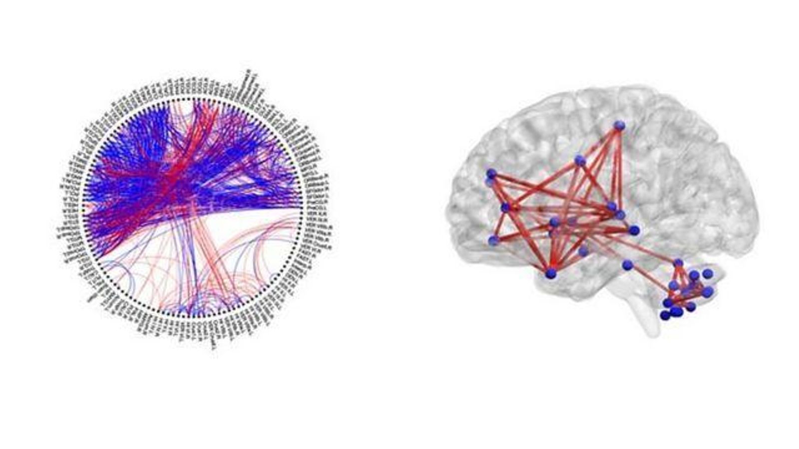 El escaneo de la actividad cerebral mostró áreas responsables de la recompensa vinculadas con áreas que impulsan el comportamiento automático y repetitivo.