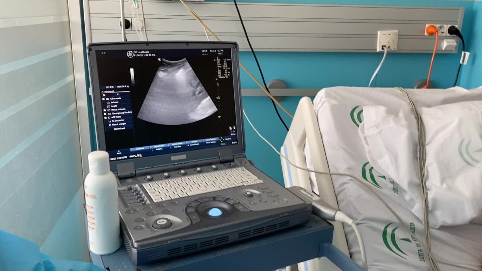 Uno de los ecógrafos portátiles para hacer la prueba en Urgencias del Hospital Regional.