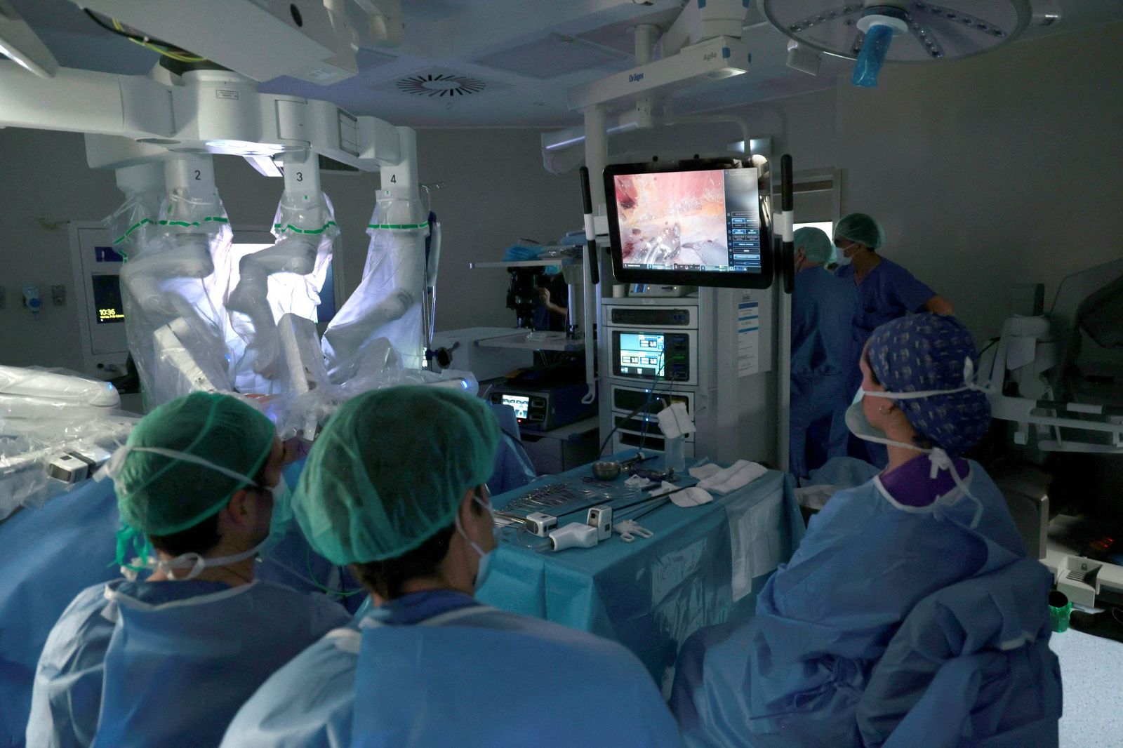 Un grupo de médicos se ayuda de la inteligencia artificial en el quirófano de un hospital de Sevilla.