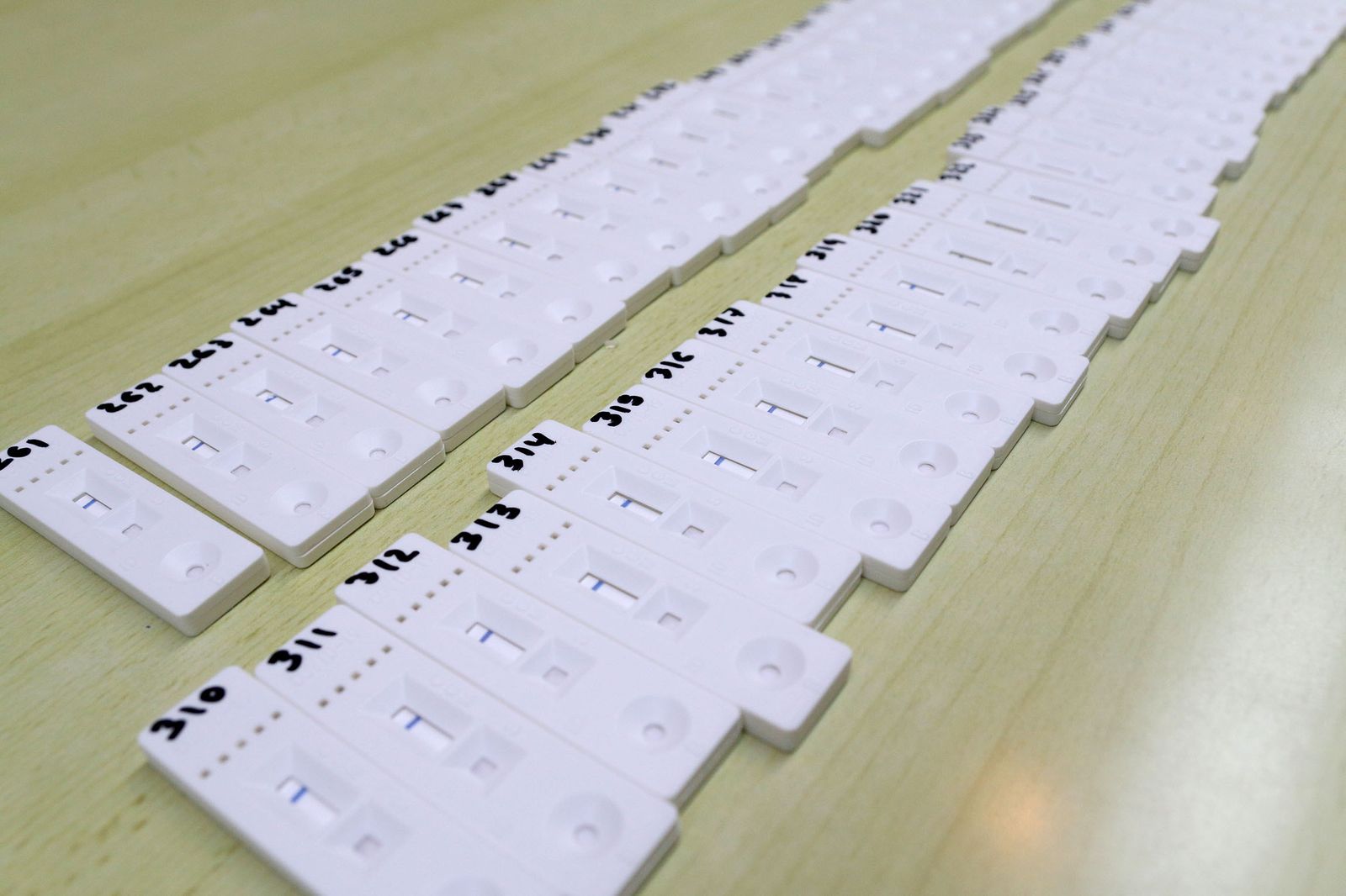 Tests serológicos de Covid.