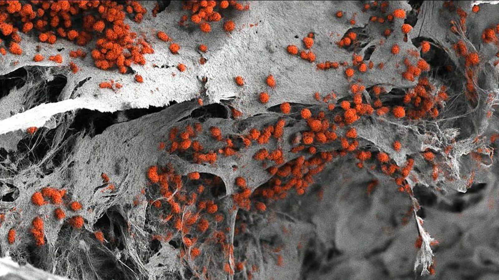 El modelo de la médula ósea visto desde un microscopio electrónico.