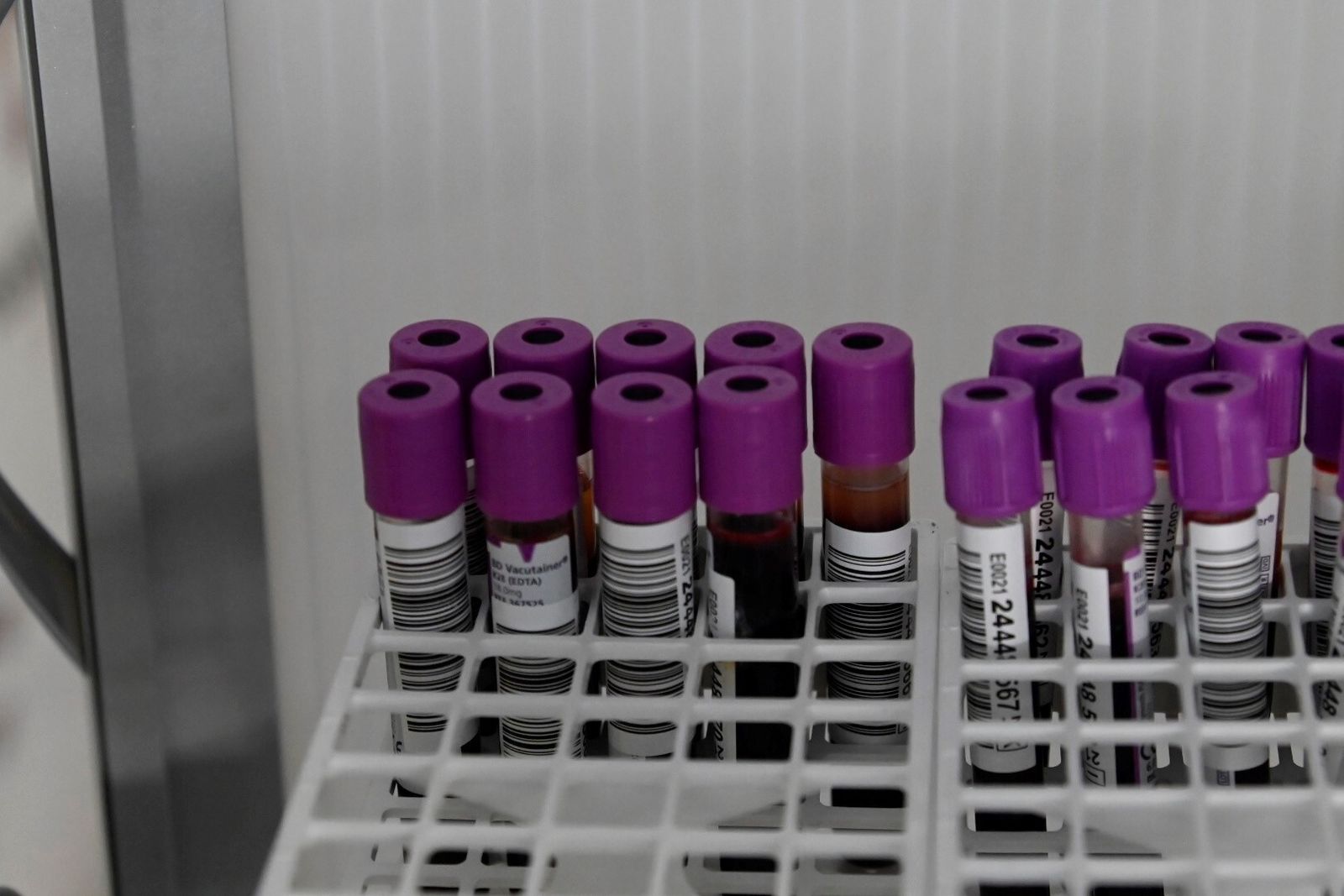 Las imágenes de la colecta de sangre en el Hospital Reina Sofía por la XXII Semana de la Donación