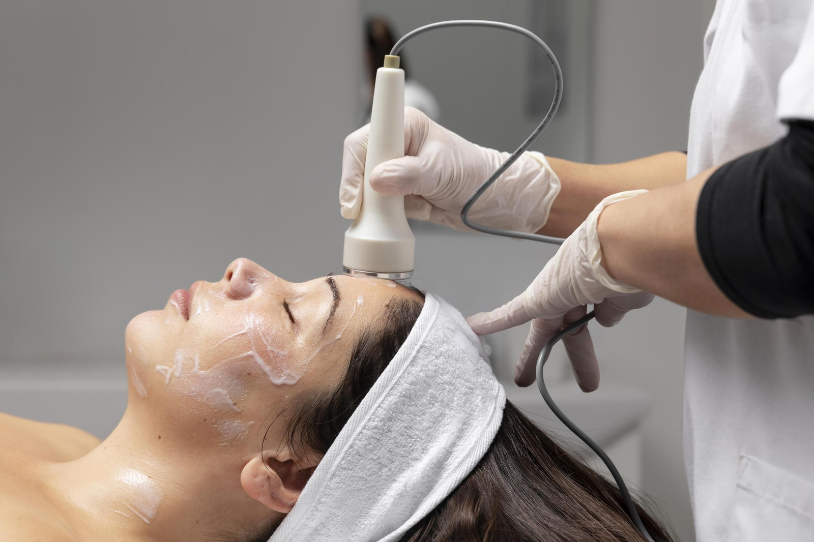 Microneedling