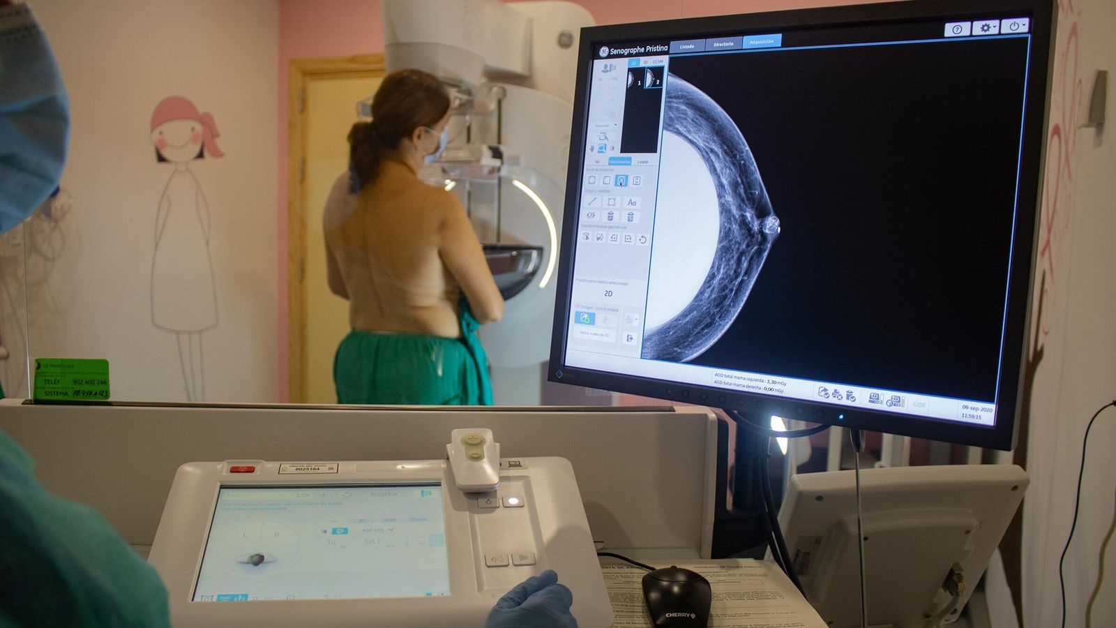 Una paciente durante la realización de una mamografía en una revisión en la unidad.