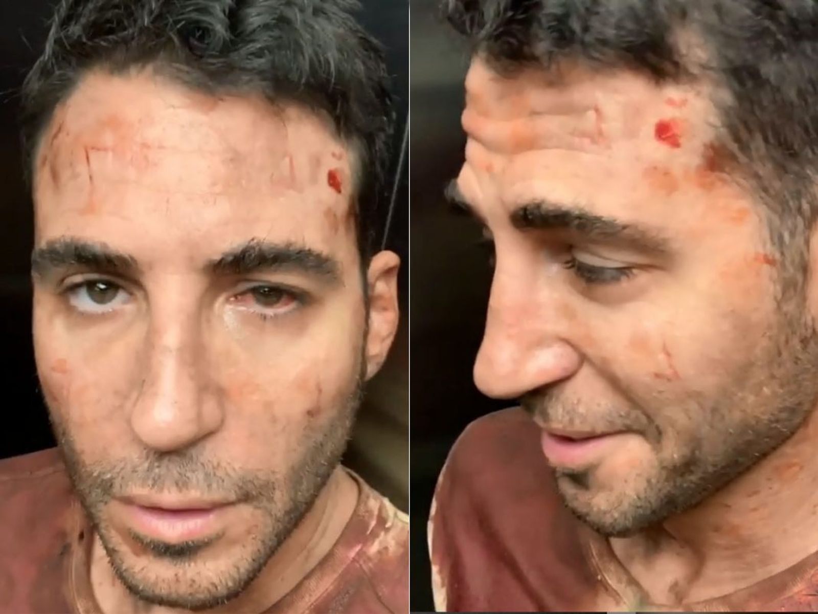Miguel Ángel Silvestre, con moratones y sangre, en las fotos que ha compartido en sus redes.