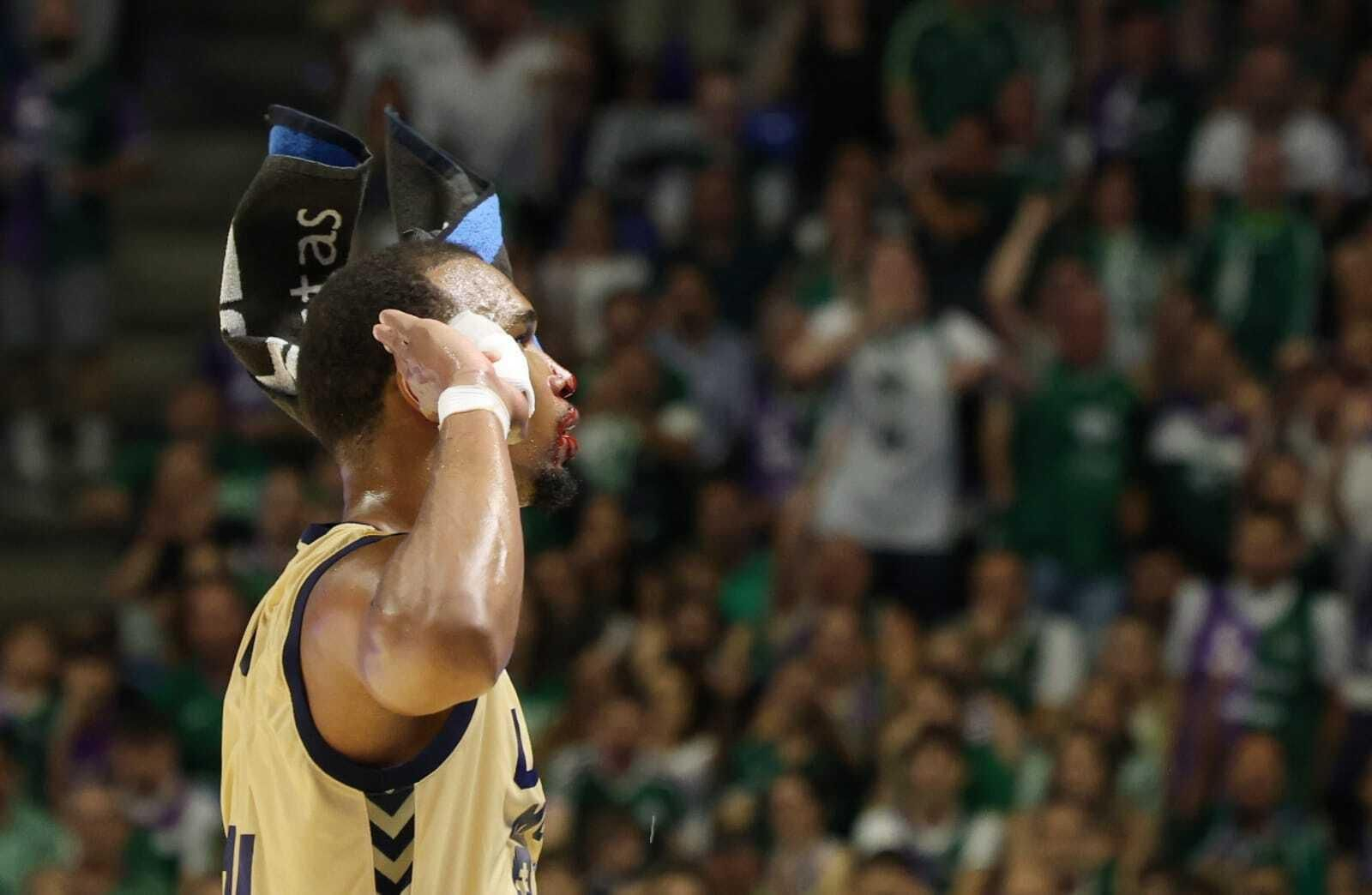 Fotos del Unicaja - UCAM Murcia