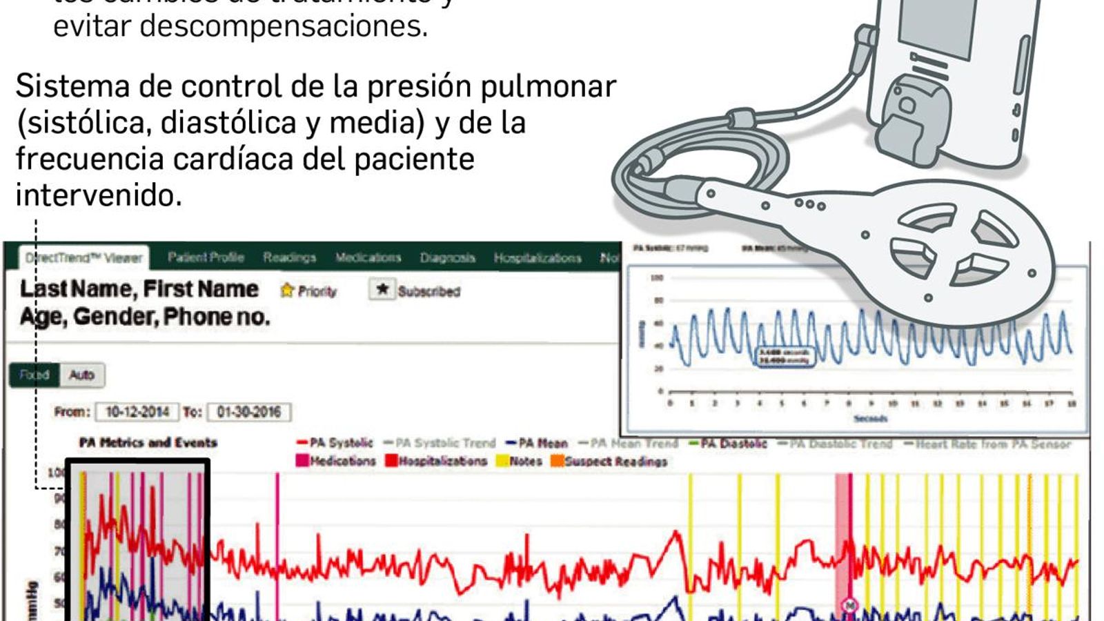 La información es recibida por los médicos a través de un sistema informático.