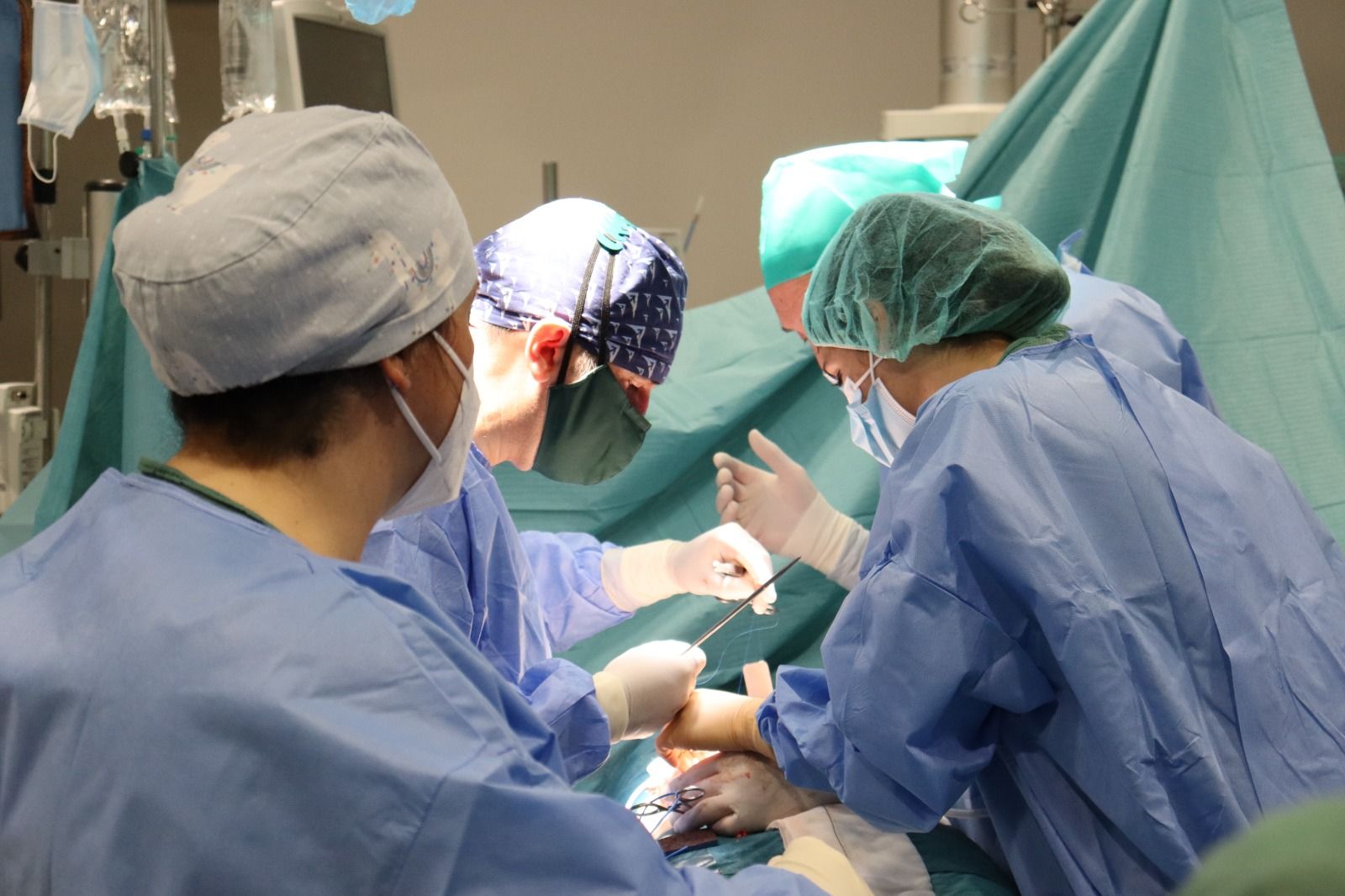 Falcultativos en una operación