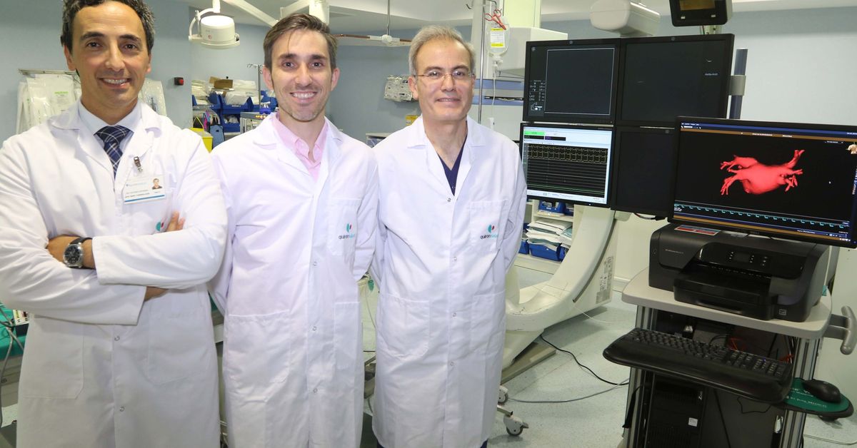 Hospital Quirónsalud Málaga incorpora la ablación por campo pulsado para tratar la fibrilación auricular