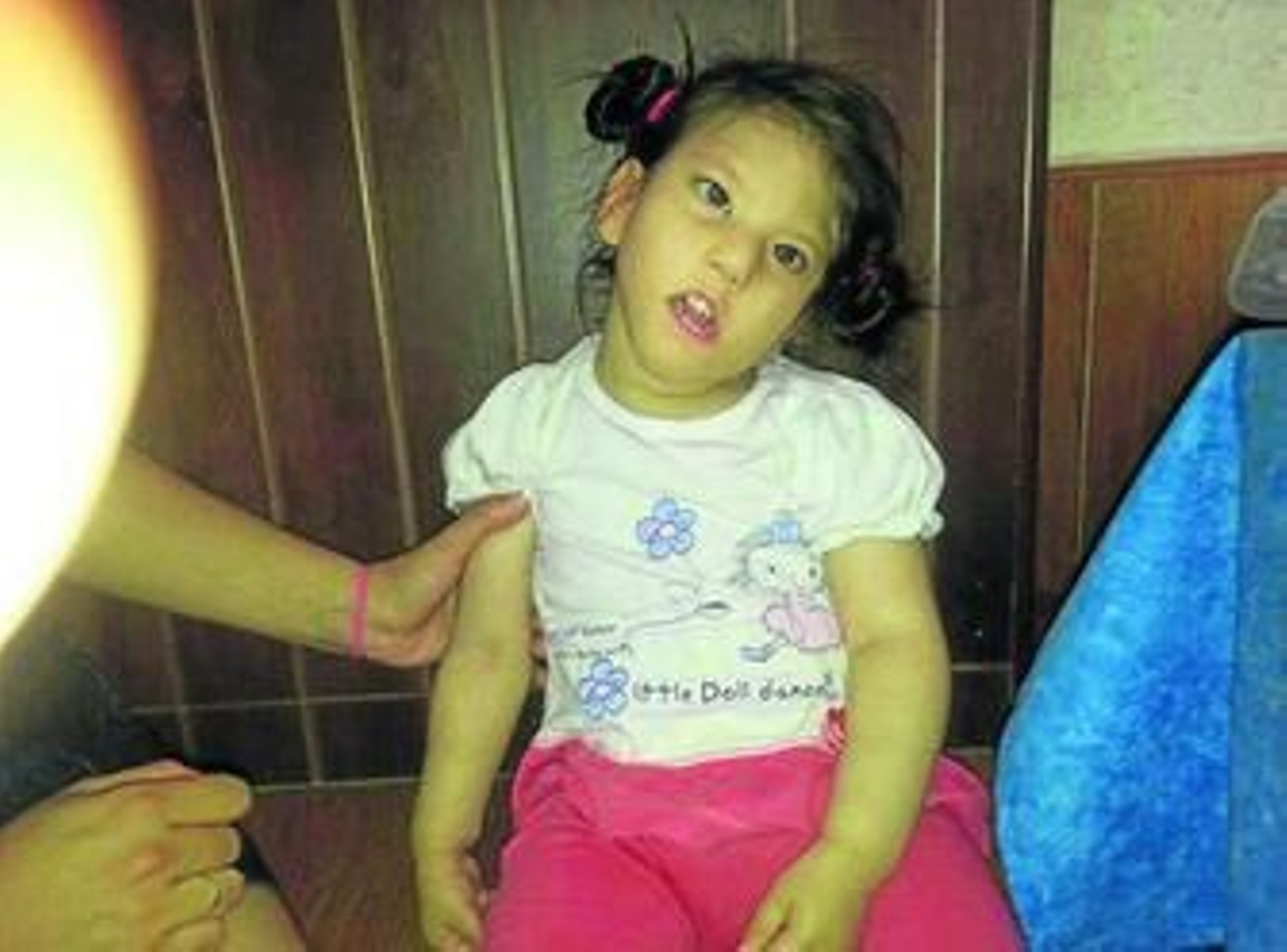 La pequeña sufre una enfermedad rara, denominada Síndrome de Moebius.