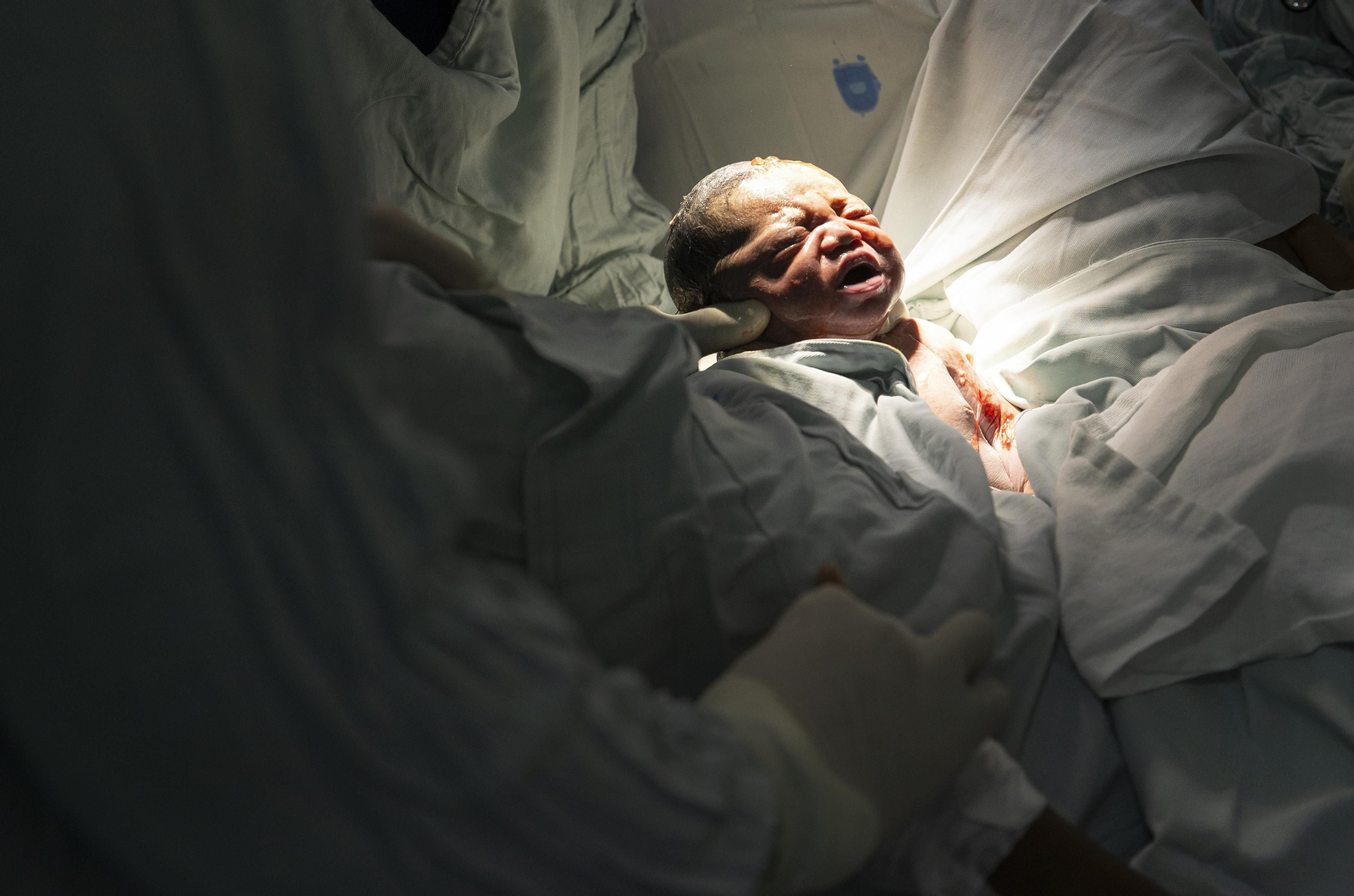 Fotografía de Damián, nacido en la maternidad de la Altagracia, en Santo Domingo