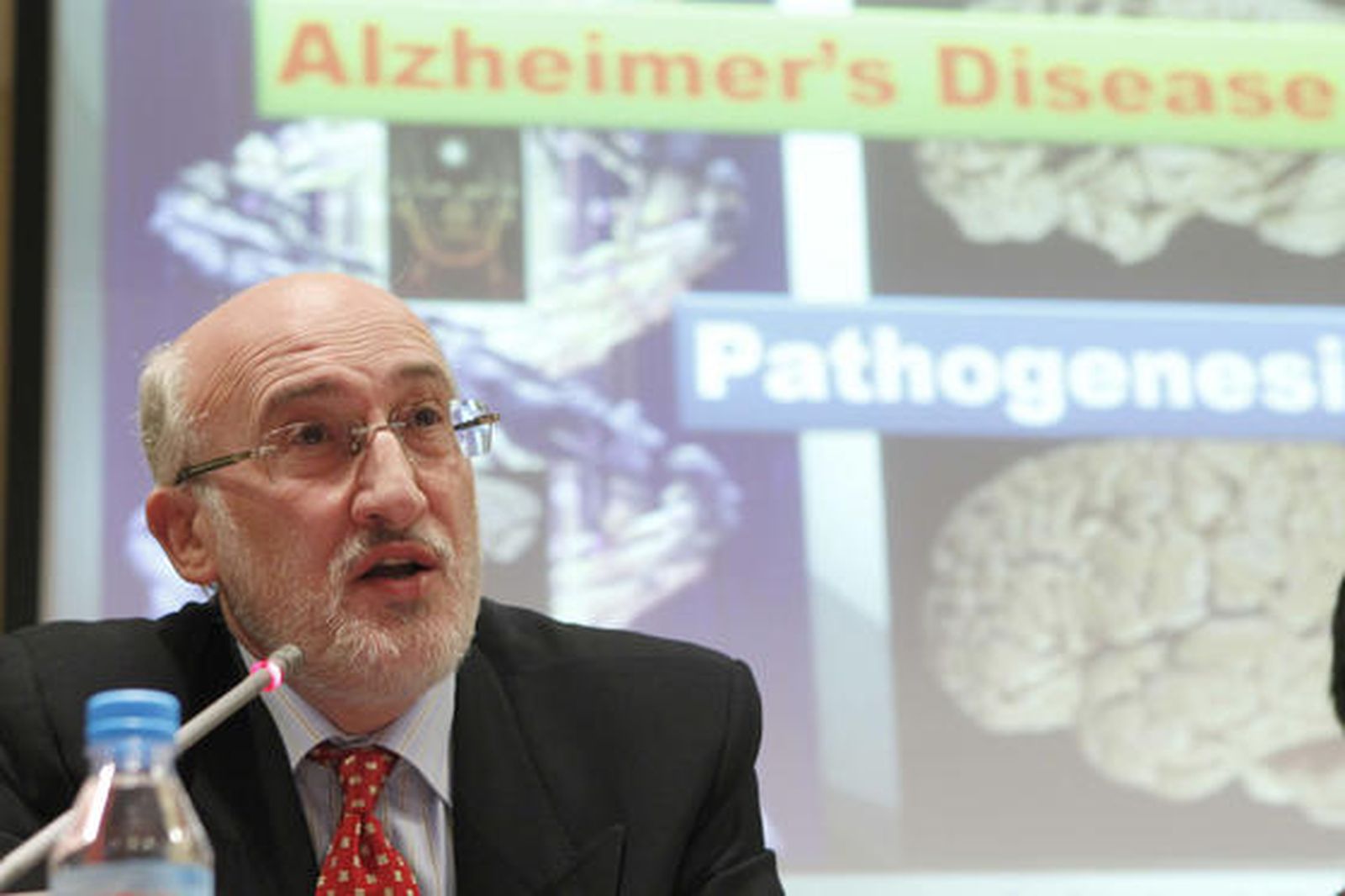 Científicos españoles diseñan una vacuna para prevenir y frenar el alzheimer