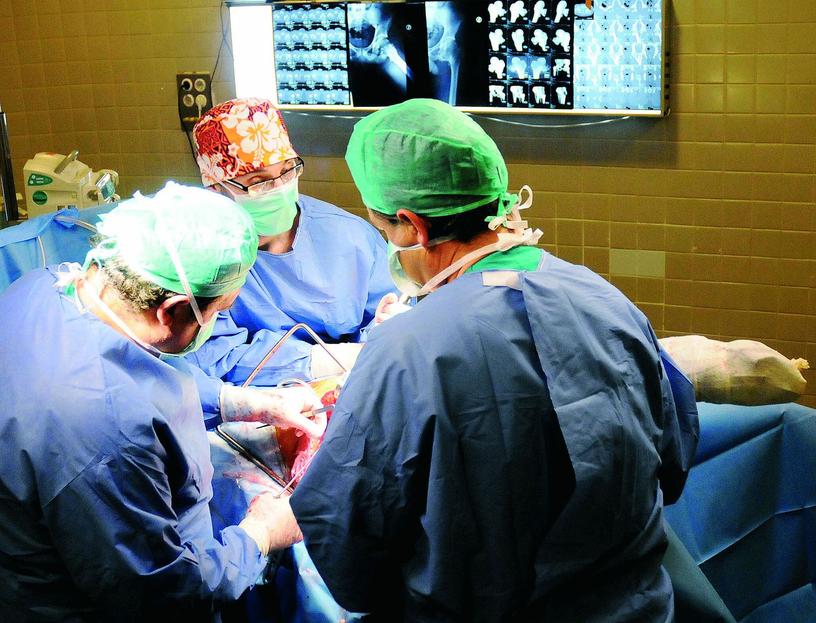 Operación de un cáncer de hueso.