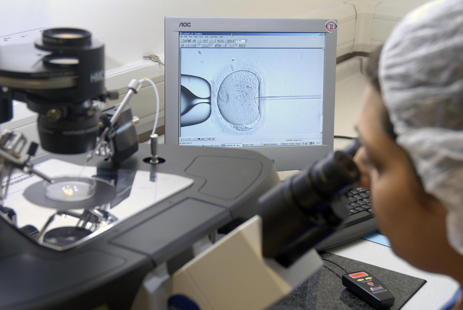 Imagen de archivo del proceso de fecundación in vitro