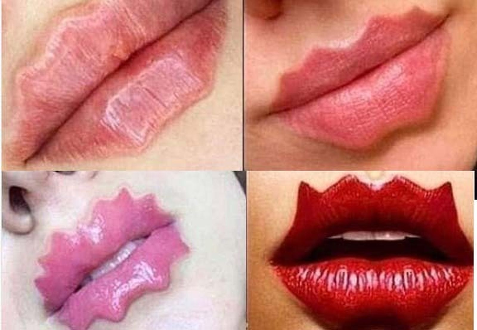 Labios del diablo: el peligroso último grito del postureo