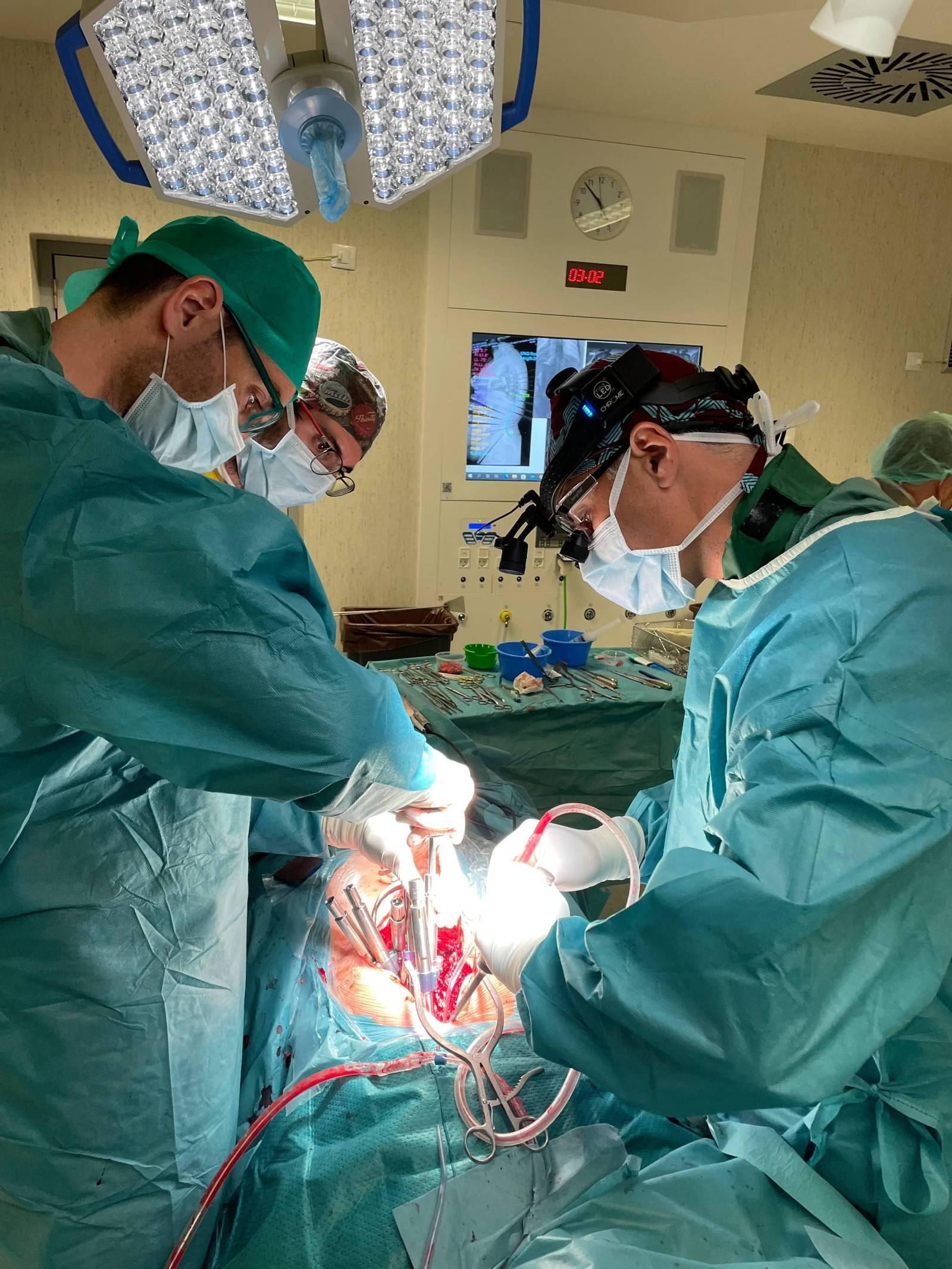 Intervención de columna aplicando inteligencia artificial.