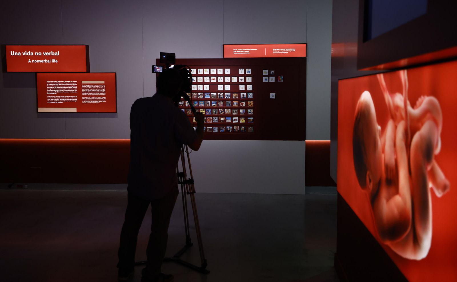 Las imágenes de la exposición interactiva “Talking Brains”