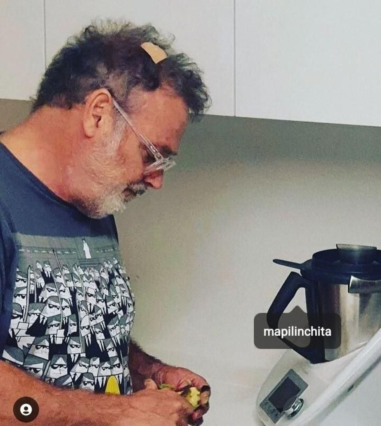 Pablo Carbonell en la cocina tras curarse de la brecha tras un golpe en el interior de su coche