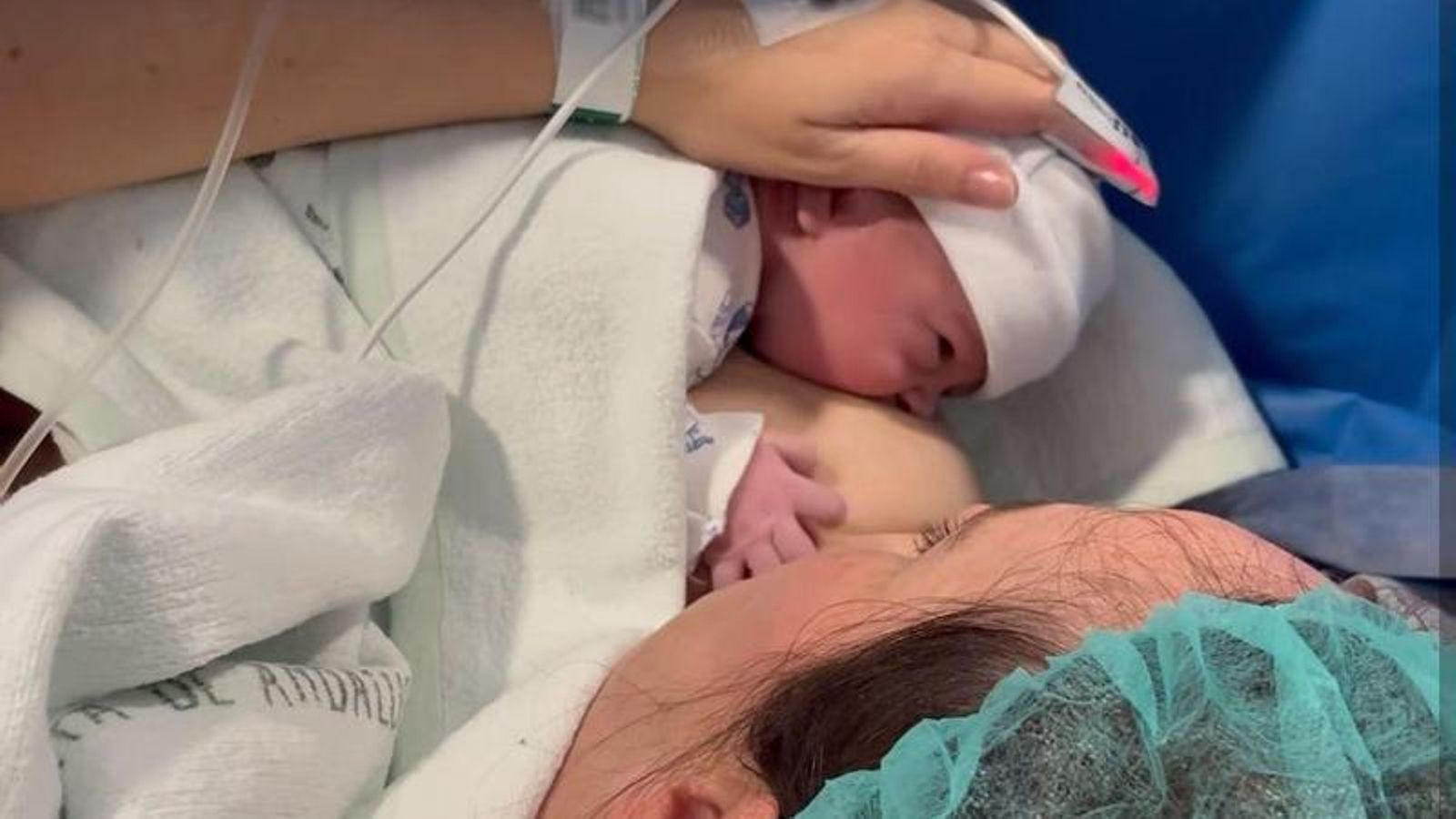 Lactancia materna durante los Cuidados Piel con Piel en el quirófano.